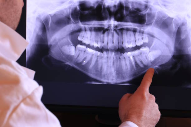 Best Urgent Dental Care for Toothache in Ipswich, SD