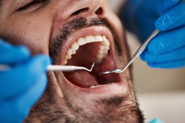 Best Emergency Dental Services for Seniors in Ipswich, SD