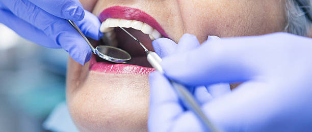 Fast & Reliable Emergency Dental Services in SD